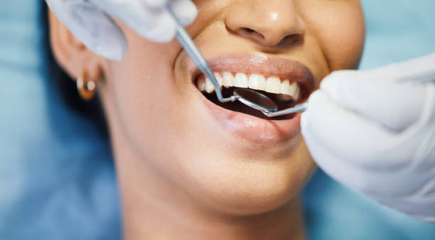 Best Emergency Wisdom Teeth Removal in Monticello, AR