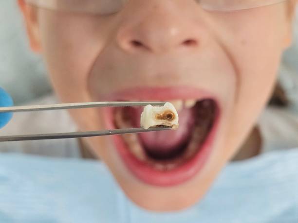 Best After-Hours Dental Trauma Care in Monticello, AR